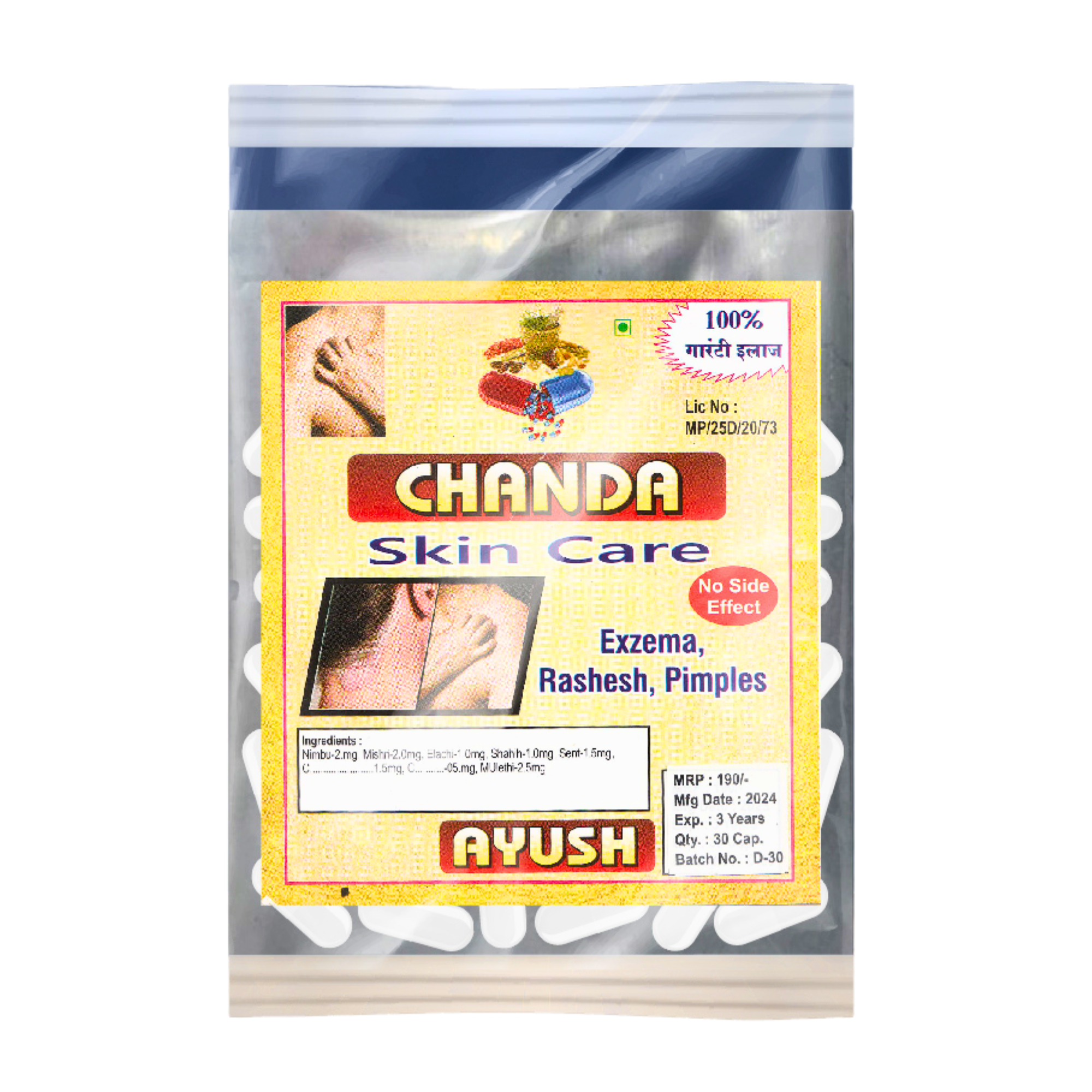 Chanda Skin Care Capsules – Ayurvedic Herbal Support for Healthy &amp; Glowing Skin