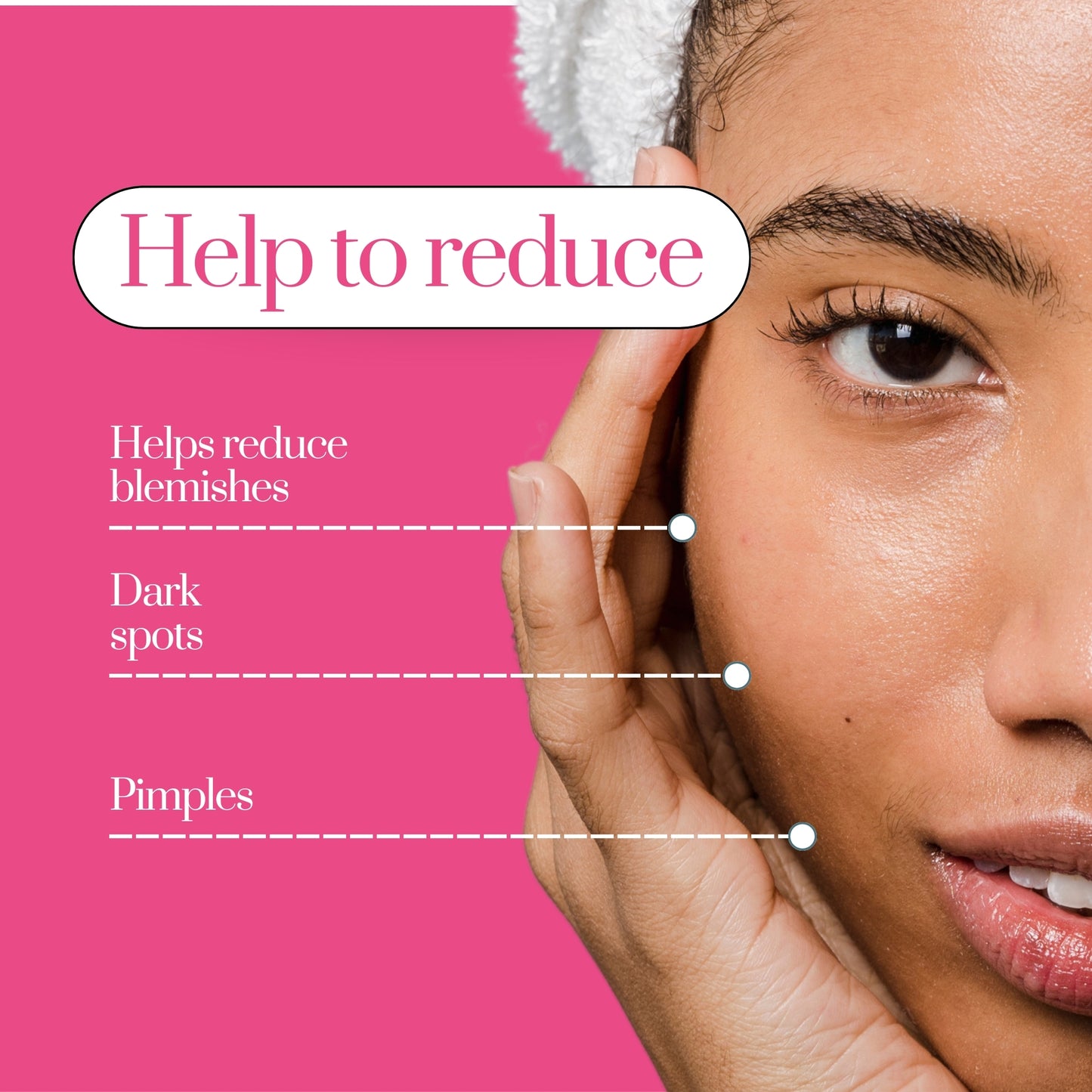 Chanda Skin Glow Cream for Dull Skin, Dark Spots & Uneven Tone – Herbal Radiance Booster – 25g