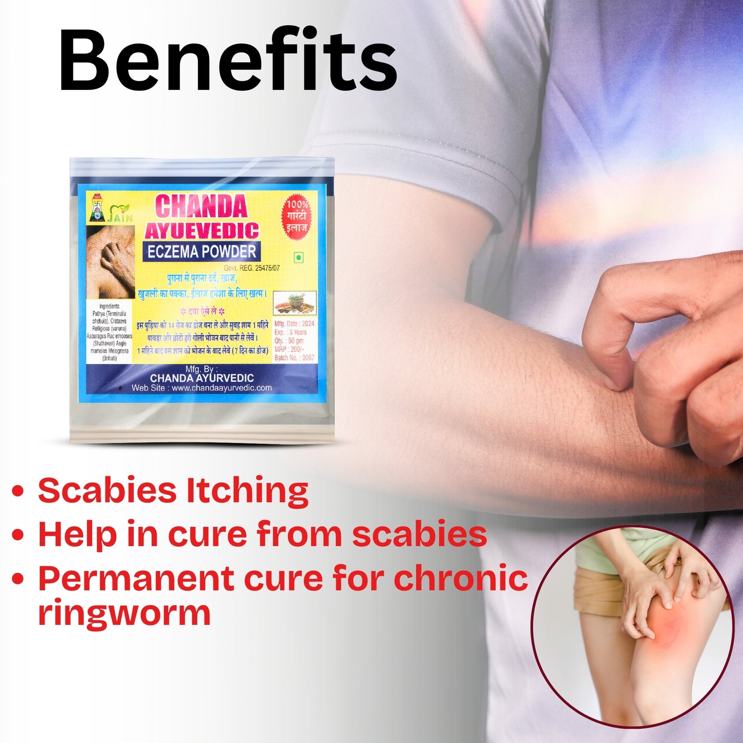 Chanda Eczema Powder for Skin Itching, Redness, Rashes, Fungal Infections – Ayurvedic Natural Cure – 50g