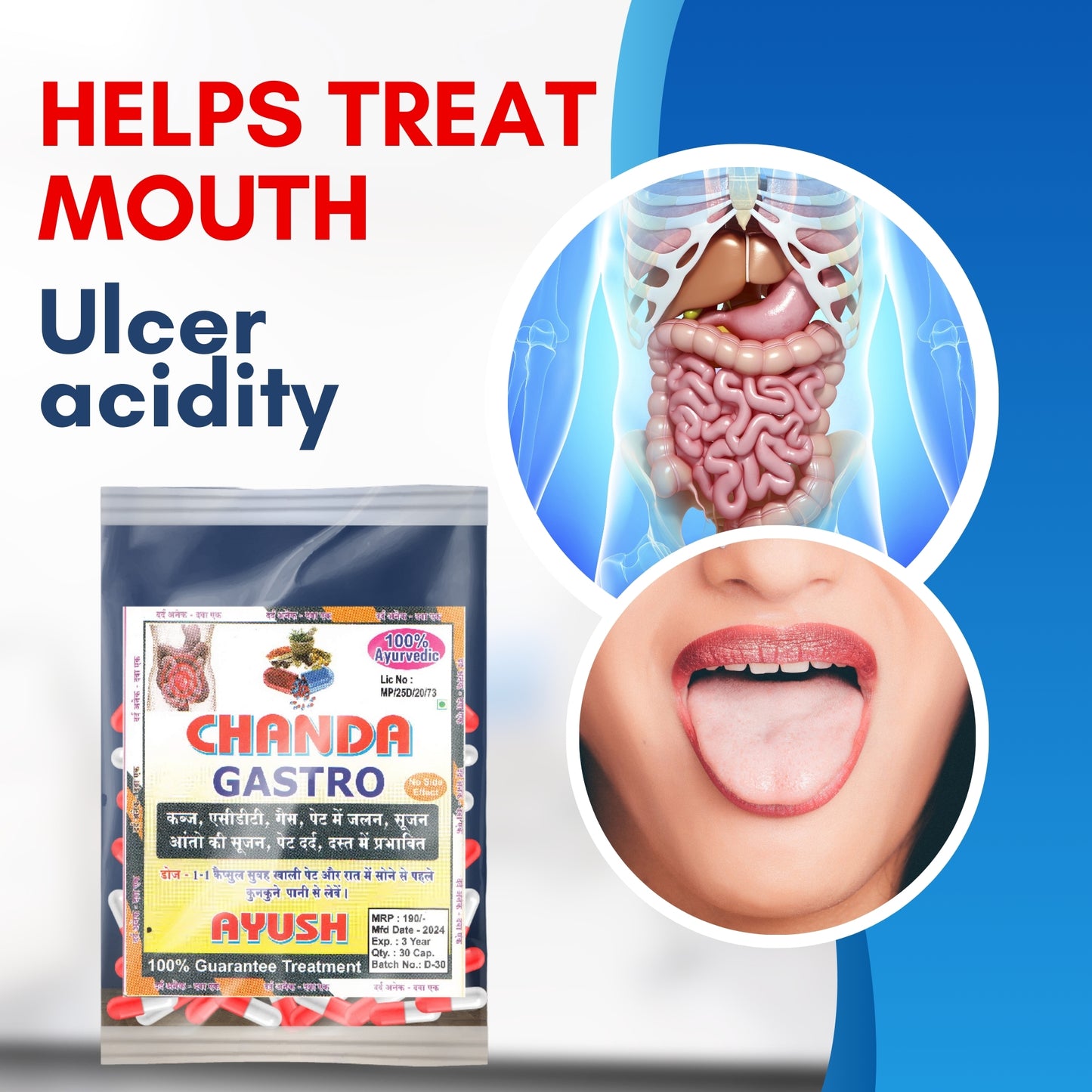 Chanda Gastro Capsules – Ayurvedic Herbal Support for Digestion & Stomach Comfort