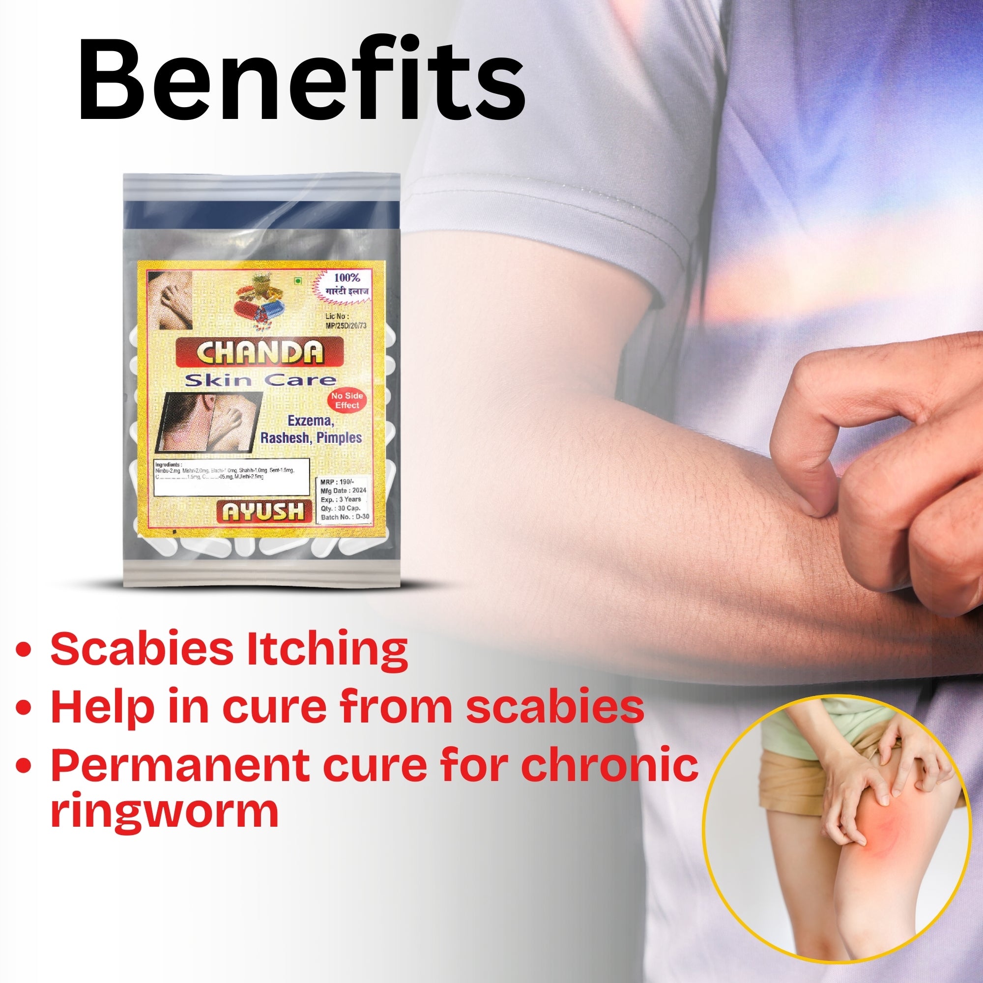 Chanda Skin Care Capsules – Ayurvedic Herbal Support for Healthy &amp; Glowing Skin