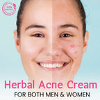 Chanda Skin Glow Cream for Dull Skin, Dark Spots & Uneven Tone – Herbal Radiance Booster – 25g
