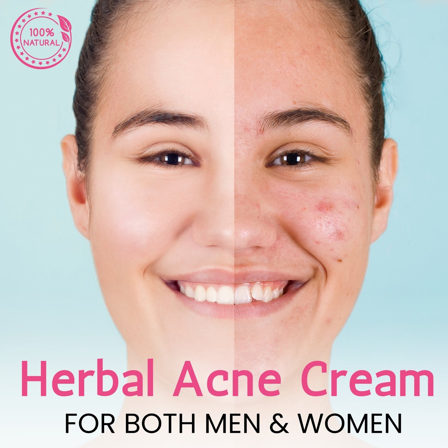 Chanda Skin Glow Cream for Dull Skin, Dark Spots & Uneven Tone – Herbal Radiance Booster – 25g