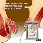 Chanda Ayurvedic Piles Powder – Natural Support for Bleeding & Non-Bleeding Piles, Fissures & Bowel Health – 50g
